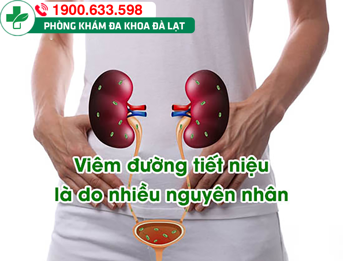 Hình ảnh minh họa